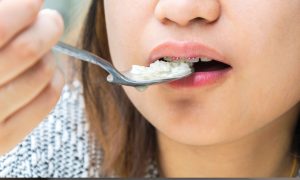 what to eat after laser gum surgery